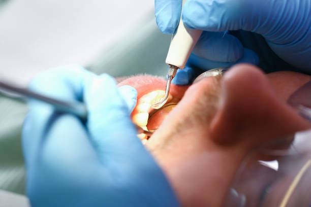 Best Knocked-Out Tooth Emergency  in Manchester, PA